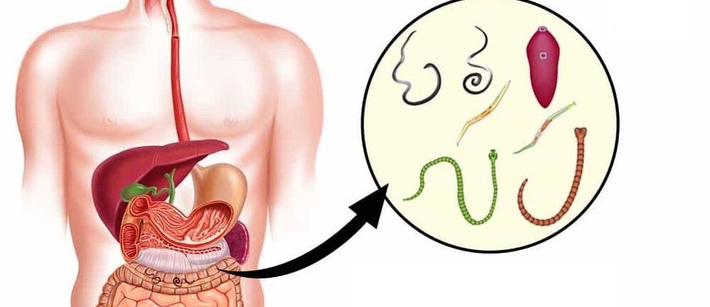 Paraziti v lidském těle