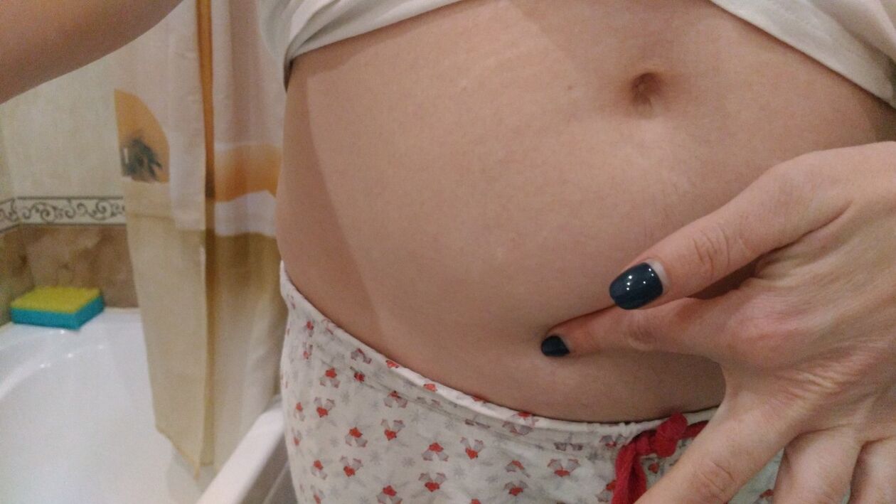 Známky helmintové infekce z osobní zkušenosti