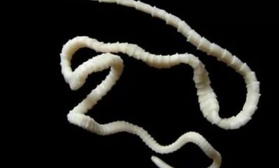 jak odstranit parazita tasemnice z těla