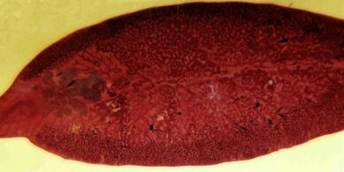 parazit motolice jak odstranit z těla