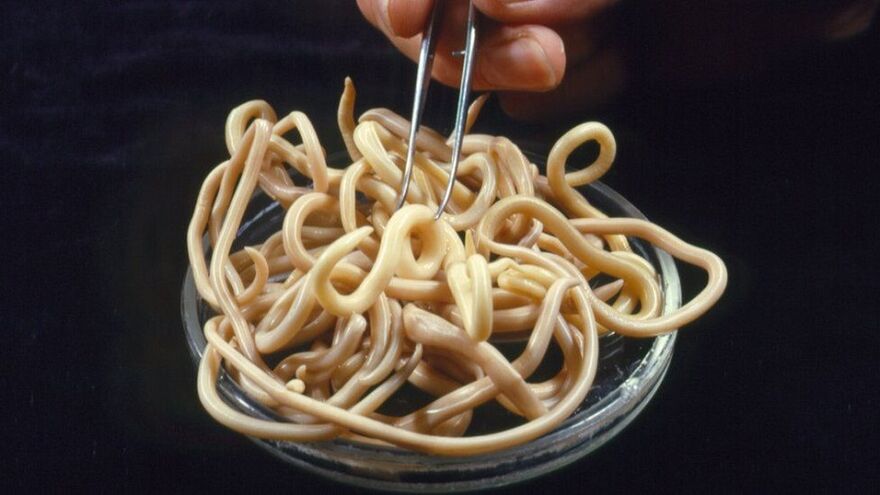 parazitů z lidského těla